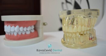 Kovačević Dental Bač